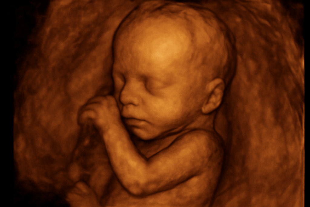 photo of an Atlanta 3d ultra sound baby photo